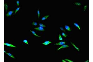 Immunofluorescent analysis of Hela cells using ABIN7148885 at dilution of 1:100 and Alexa Fluor 488-congugated AffiniPure Goat Anti-Rabbit IgG(H+L) (CDKN2B antibody  (AA 1-138))