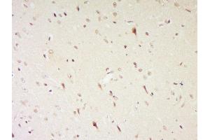 Paraformaldehyde-fixed, paraffin embedded rat brain, Antigen retrieval by boiling in sodium citrate buffer (pH6) for 15min, Block endogenous peroxidase by 3% hydrogen peroxide for 30 minutes, Blocking buffer (normal goat serum) at 37°C for 20min, Antibody incubation with NGB/neuroglobin Polyclonal Antibody, Unconjugated  at 1:500 overnight at 4°C, followed by a conjugated secondary and DAB staining (Neuroglobin antibody  (AA 51-151))