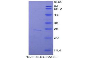 SDS-PAGE analysis of Rat TNIP2 Protein. (TNIP2 Protein)
