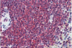ABIN571033 (2. (CA1 antibody  (Internal Region))