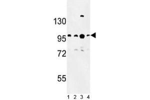 Western blot analysis of BCL11A antibody and 1) Jurkat, 2) Ramos, 3) 293 and 4)NCI-H460 lysate. (BCL11A antibody  (AA 806-835))