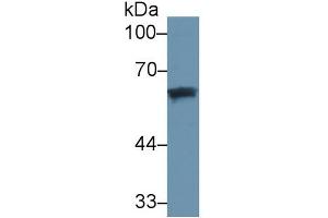 Western Blotting (WB) image for Vitamin D-Binding Protein (GC) ELISA Kit (ABIN6730869)
