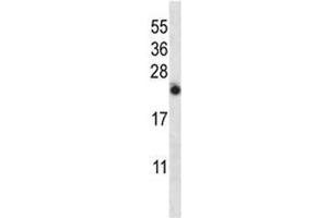 Western Blotting (WB) image for anti-Interleukin 13 (IL13) (AA 118-146) antibody (ABIN3031449)