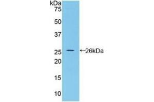 Detection of Recombinant BMP2, Rat using Polyclonal Antibody to Bone Morphogenetic Protein 2 (BMP2) (BMP2 antibody  (AA 49-243))