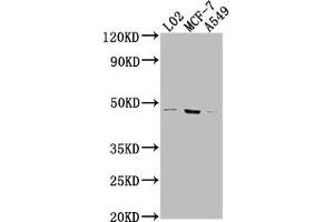 Western Blot Positive WB detected in: LO2 whole cell lysate, MCF-7 whole cell lysate, A549 whole cell lysate All lanes: USP17L6P antibody at 1:2000 Secondary Goat polyclonal to rabbit IgG at 1/50000 dilution Predicted band size: 45 kDa Observed band size: 45 kDa (USP17L6P antibody  (C-Term))