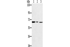 Western Blotting (WB) image for anti-Insulin-Like Growth Factor 2 mRNA Binding Protein 3 (IGF2BP3) antibody (ABIN2428264) (IGF2BP3 antibody)