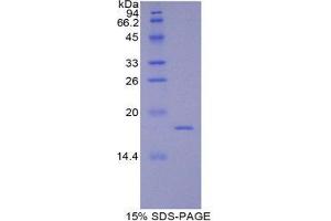 SDS-PAGE (SDS) image for Coagulation Factor VIII (F8) (AA 1854-1988) protein (His tag) (ABIN1877781) (Factor VIII Protein (AA 1854-1988) (His tag))