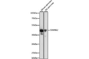 Western blot analysis of extracts of various cell lines, using SERPINI2 antibody (ABIN6131321, ABIN6147617, ABIN6147618 and ABIN6215429) at 1:1000 dilution. (SERPINI2 antibody  (AA 56-405))
