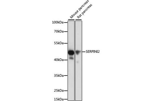 SERPINI2 antibody  (AA 56-405)