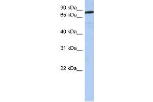 WB Suggested Anti-SEMA4B Antibody Titration:  0. (SEMA4B antibody  (N-Term))