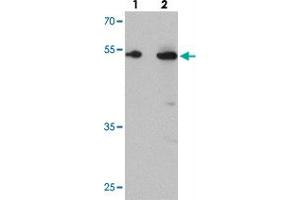 Western blot analysis of TMEM135 in rat liver tissue with TMEM135 polyclonal antibody  at (lane 1) 1 and (lane 2) 2 ug/mL. (TMEM135 antibody  (C-Term))