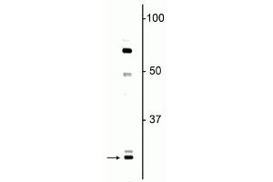 Western blot of neonatal rat brain lysate showing specific immunolabeling of the ~ 27 kDa Olig1 protein. (OLIG1 antibody)