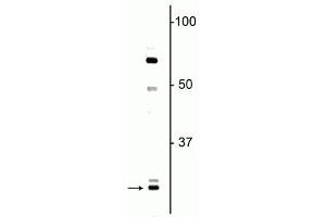 Western blot of neonatal rat brain lysate showing specific immunolabeling of the ~ 27 kDa Olig1 protein.