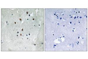 Immunohistochemistry analysis of paraffin-embedded human brain tissue using SRF (Phospho-Ser77) antibody. (SRF antibody  (pSer77))
