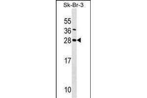 SDC4 Antibody (Center) (ABIN1538722 and ABIN2848544) western blot analysis in SK-BR-3 cell line lysates (35 μg/lane). (SDC4 antibody  (AA 98-127))