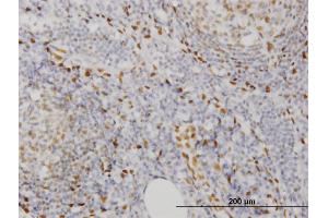 Immunoperoxidase of monoclonal antibody to EBF3 on formalin-fixed paraffin-embedded human lymph node. (EBF3 antibody  (AA 381-480))