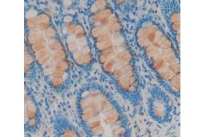 Figure. (PPIC antibody  (AA 5-201))
