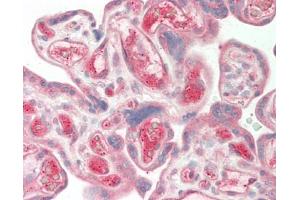 Human Placenta: Formalin-Fixed, Paraffin-Embedded (FFPE). (Afamin antibody  (AA 22-210) (Biotin))