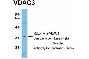Host: Rabbit Target Name: VDAC3 Sample Type: Human Fetal Muscle Antibody Dilution: 1. (VDAC3 antibody  (N-Term))