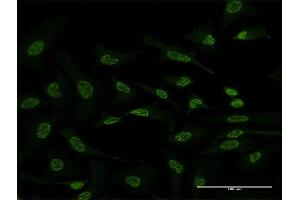 Immunofluorescence of monoclonal antibody to ATF2 on HeLa cell. (ATF2 antibody  (AA 91-190))