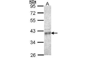 WB Image Sample (30 ug of whole cell lysate) A: HCT116 10% SDS PAGE antibody diluted at 1:1000 (CPOX antibody)