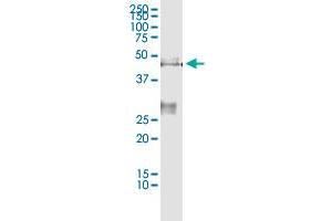 Immunoprecipitation (IP) image for RRM2 (Human) IP-WB Antibody Pair (ABIN2752034)