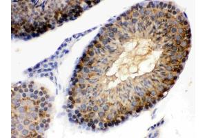 IHC analysis of Hsp90 alpha using anti-Hsp90 alpha antibody (ABIN3043848).