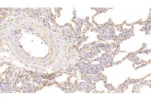 Detection of IL9 in Human Lung Tissue using Polyclonal Antibody to Interleukin 9 (IL9) (IL-9 antibody  (AA 19-144))