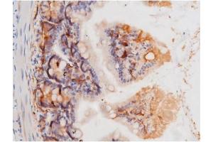 ABIN6267364 at 1/200 staining Mouse intestinal tissue sections by IHC-P.