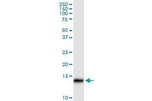 Immunoprecipitation (IP) image for anti-ISG15 Ubiquitin-Like Modifier (ISG15) (AA 1-165) antibody (ABIN523128)