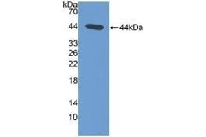 Detection of Recombinant NT-ProANP, Rat using Polyclonal Antibody to N-Terminal Pro-Atrial Natriuretic Peptide (NT-ProANP) (PRO-ANP antibody  (AA 25-122))