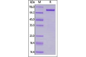 Human LAG-3, Llama IgG2b Fc Tag on  under reducing (R) condition. (LAG3 Protein (AA 23-450) (Fc Tag))
