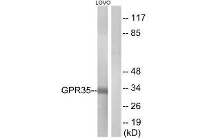 Western Blotting (WB) image for anti-G Protein-Coupled Receptor 35 (GPR35) (Internal Region) antibody (ABIN1853038) (GPR35 antibody  (Internal Region))
