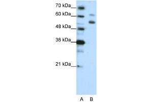 WB Suggested Anti-WDR4 Antibody Titration:  1. (WDR4 antibody  (C-Term))