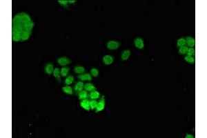 Immunofluorescent analysis of PC-3 cells using ABIN7153101 at dilution of 1:100 and Alexa Fluor 488-congugated AffiniPure Goat Anti-Rabbit IgG(H+L)