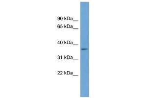 BACE2 antibody used at 1 ug/ml to detect target protein.