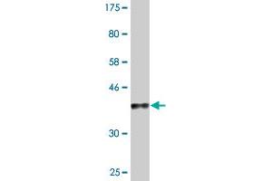 Western Blot detection against Immunogen (37. (MYBL1 antibody  (AA 625-734))