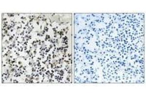 Immunohistochemistry analysis of paraffin-embedded human lymph node tissue using CLIC4 antibody. (CLIC4 antibody  (N-Term))