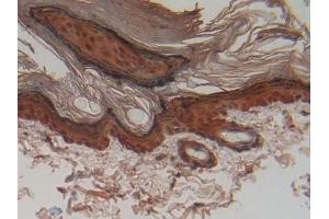 DAB staining on IHC-P; Samples: Rat Skin Tissue (CSTA antibody  (AA 1-103))
