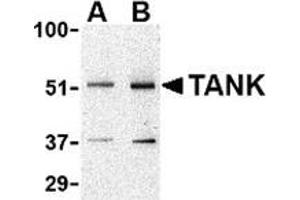 Western blot analysis of TANK in Daudi cell lysate with this product at (A) 0. (TANK antibody  (N-Term))