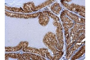 Immunohistochemistry (IHC) image for anti-Hydroxysteroid (17-Beta) Dehydrogenase 10 (HSD17B10) (C-Term) antibody (ABIN2854703)