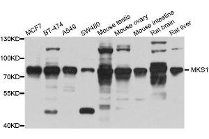 Western blot analysis of extracts of various cell lines, using MKS1 antibody. (MKS1 antibody  (AA 150-300))