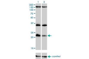 Western blot analysis of DUSP22 over-expressed 293 cell line, cotransfected with DUSP22 Validated Chimera RNAi (Lane 2) or non-transfected control (Lane 1).