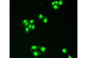 Figure:FITC staining on IHC-P Simple: Hela cells (XPO1 antibody  (AA 917-1071))