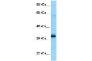 Image no. 1 for anti-Phosphopantothenoylcysteine Synthetase (PPCS) (C-Term) antibody (ABIN6748412) (PPCS antibody  (C-Term))