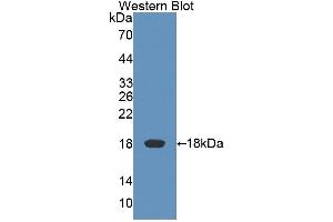 Detection of Recombinant KLRK1, Rat using Polyclonal Antibody to Killer Cell Lectin Like Receptor Subfamily K, Member 1 (KLRK1) (KLRK1 antibody  (AA 75-215))