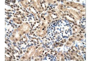 IFIT3 antibody was used for immunohistochemistry at a concentration of 4-8 ug/ml. (IFIT3 antibody  (N-Term))