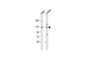 All lanes : Anti-DIS3 Antibody (Center) at 1:1000 dilution Lane 1: Hela whole cell lysate Lane 2: Jurkat whole cell lysate Lysates/proteins at 20 μg per lane. (DIS3 antibody  (AA 295-323))