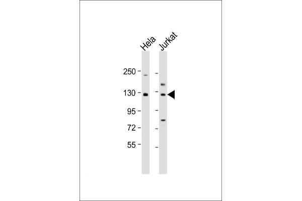 DIS3 Antikörper  (AA 295-323)