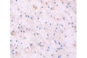 Figure. (Dermcidin antibody  (AA 18-110))
